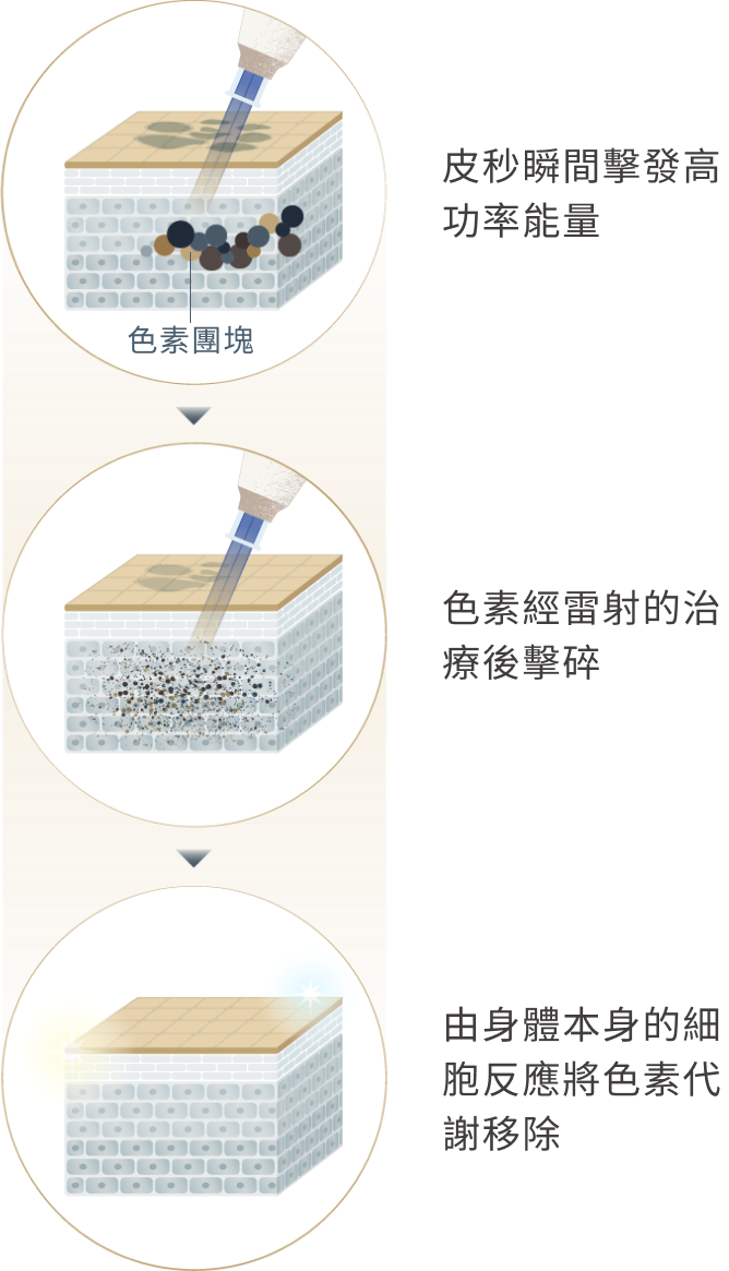 多波長 超短脈衝mb